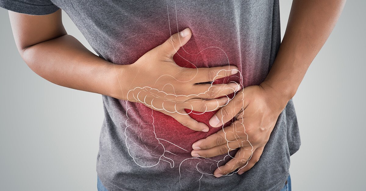 Unraveling Crohn’s Disease: Symptoms, Causes, and Treatment Options
