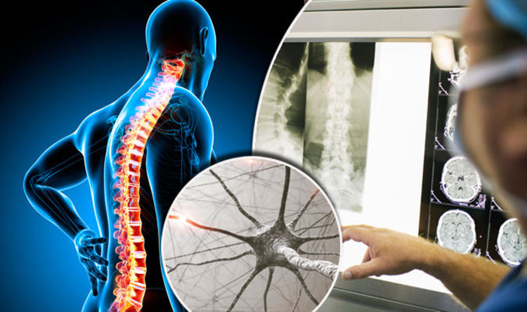Motor Neuron Disease: Shedding Light on a Complex Neurological Condition Motor Neuron Disease: Shedding Light on a Complex Neurological Condition