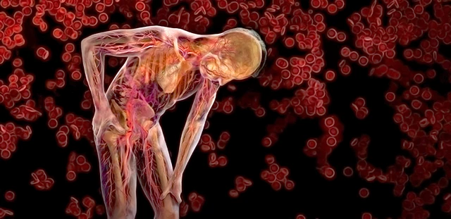 Understanding Beta Thalassemia: Symptoms, Causes, and Treatment Options Understanding Beta Thalassemia: Symptoms, Causes, and Treatment Options