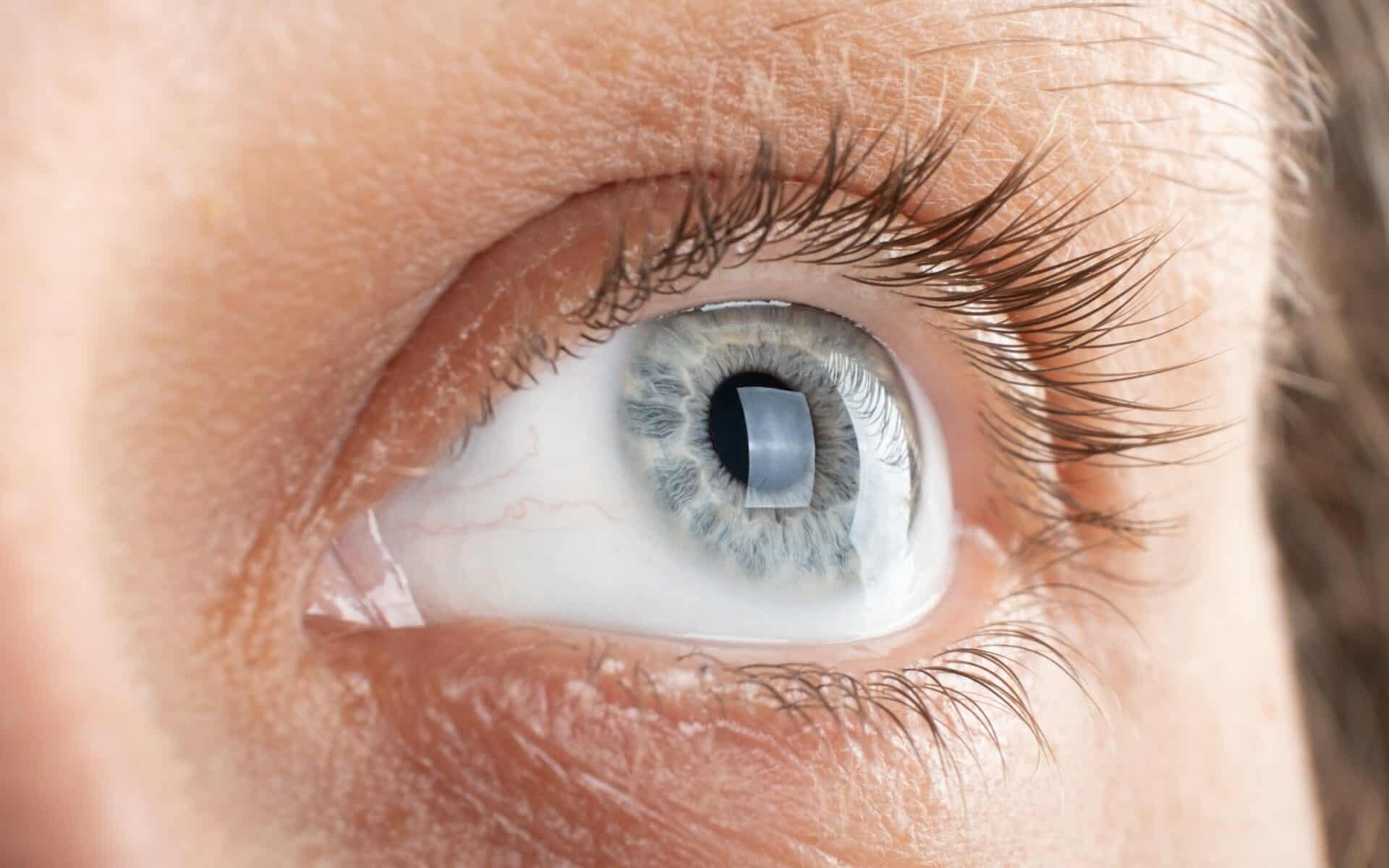 Corneal Diseases: Understanding Symptoms, Causes, and Support Options Corneal Diseases: Understanding Symptoms, Causes, and Support Options
